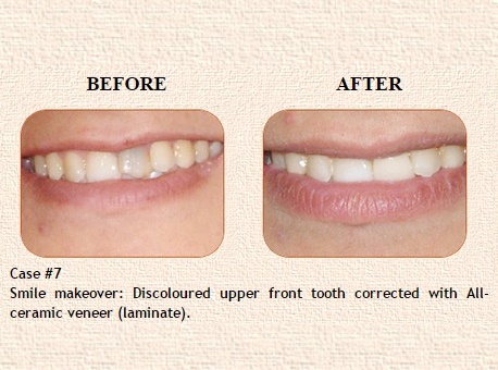 Cosmetic Dentist in Civil Lines