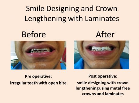 smile makeover dental clinic Delhi
