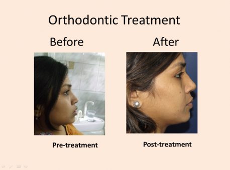 Orthodontic Dental Clinic Delhiq